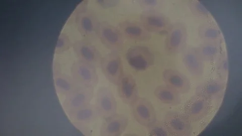 The study of chromosomes under a microscope Stock Footage 75310389