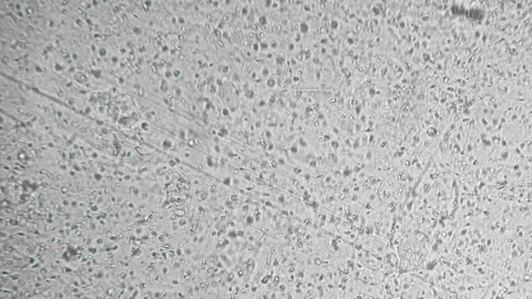Study of a genetic sample. Reproductive function of man. Slow motion filming of Stock Footage 258641311