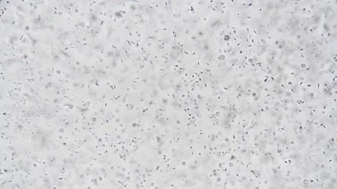 Study involves tracking sperm motility through microscopic analysis and lighting Stock Footage 343952279