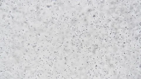 Study involves tracking sperm motility through microscopic analysis and lighting Stock-Fotos