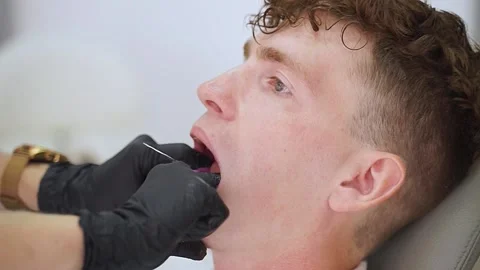 Study of malocclusion, removal of plaster casts Video stock 167303680