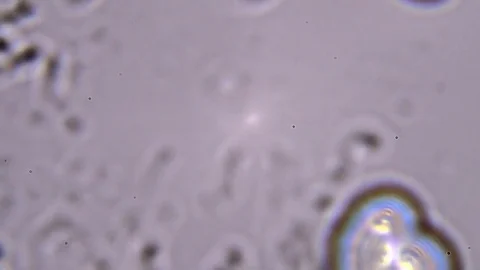 The study sample through a microscope. The movement of erythrocytes Stock Footage