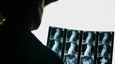 Studying MRI spinal scan, spine x-ray, doctor making a diagnosis Stock Footage
