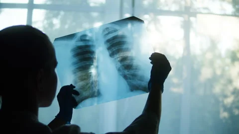 Studying X-ray image of human chest on window background, doctor checking Stock Footage 157892606