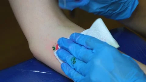Stuffing a tattoo with a needle. The process of stuffing a tattoo close-up. Hand Stock Footage 218463991