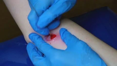 Stuffing a tattoo with a needle. The process of stuffing a tattoo close-up. Hand Stock Footage 233988215