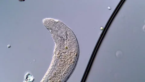 Stunning Flatworm Under the Microscope in High Resolution 스톡 동영상 317210728