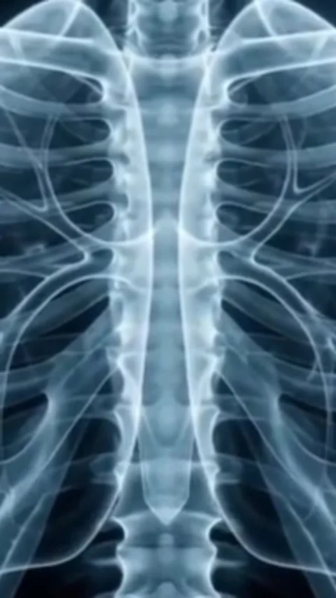 A stylized, conceptual X-ray image of the human ribcage and spine, Stock Footage 340318409