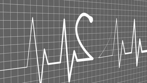 Stylized ECG Line with Heart Shape, A stylized electrocardiogram line with .. Vidéo 305165558