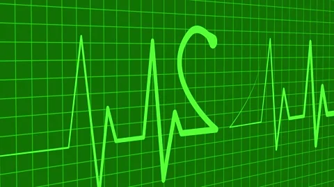 Stylized ECG Line with Heart Shape, A stylized electrocardiogram line with .. Vidéo 305165606