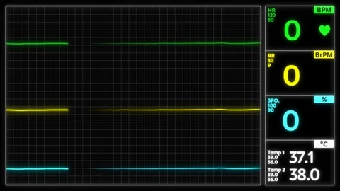 Stylized EKG Flatline, Green. Close up on pixelated heart rate monitor screen Stock Footage