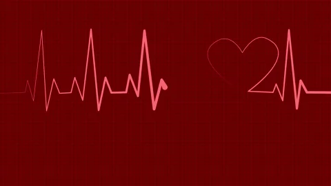 Stylized Electrocardiogram Animation, A stylized representation of an elect.. Stock Footage 305167026