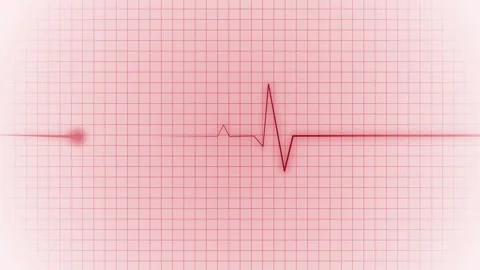 Stylized Electrocardiogram Waveform Animation, A stylized of an electrocard.. Stock Footage 305194311