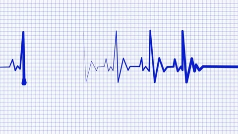 Stylized Heartbeat Line on Grid Background, Smooth Minimal Heartbeat Signal.. Stock Footage 309965730