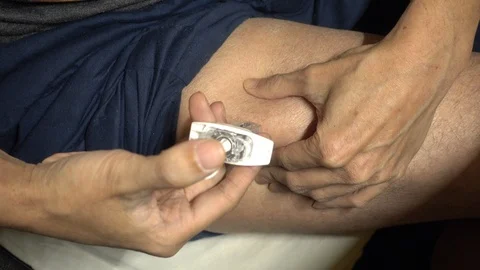Subcutaneous injection at upper thigh injection site. Self-injection Stock Footage 118673499