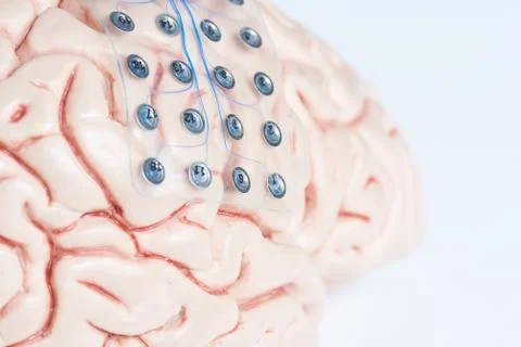 Subdural grid electrode for brain waves recording on the brain model Stock Photos