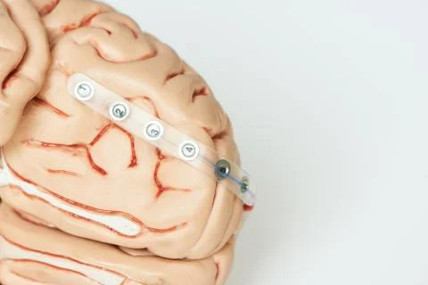 Subdural grid electrode for brain waves recording on the base of  brain Stock Photos
