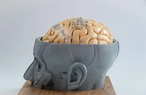 Subdural grid electrode for brain waves recording on the brain model Stock Photos