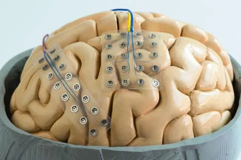 Subdural grid electrode for brain waves recording on the brain model Stock Photos