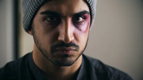 Suffering sad wounded latin man looking camera Stock Footage