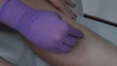 Sugar paste. Sugaring, depilation. Smooth skin legs. Waxing with sugar. Stock Footage 89063788