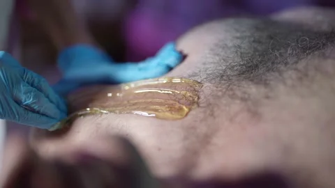 Sugaring for men, master of sugar waxing is removing hair on male chest Видео 168319247