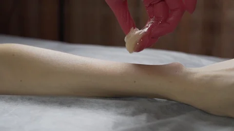 Sugarnig procedure on hand. Slow motion 100 frames Stock Footage 124498808