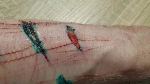 Suicide attempt. Drawing cuts. Cut the hand. Wounds on the body. Stock Footage 126102571