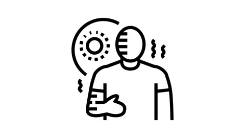 Sunburn hot line icon animation Stock Footage 326133078