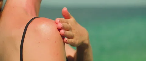 Sunscreen on shoulder skin. Cream application on skin with sea behind Video stock 263782914
