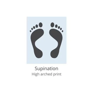 Supination - high arched print of human foot with medical deformity and leg a Stock-Illustration