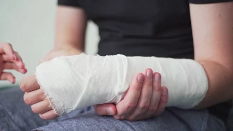 Support and care for the patient with a broken arm. The hand is in gypsum Видео 132997629