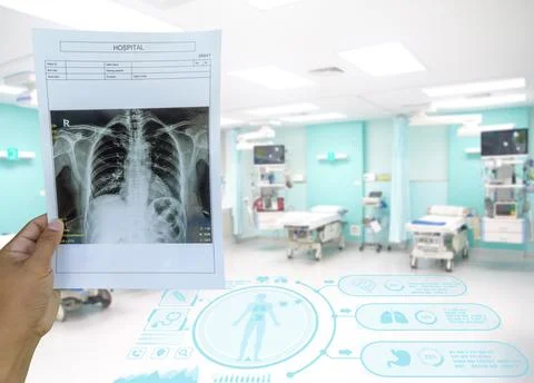 Surface blur View doctor checking chest x-ray and bed Of Empty Emergency Ro.. Stock Photos