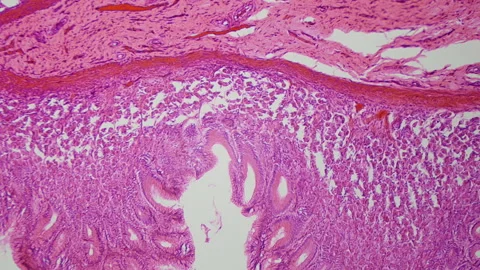 The surface of the human stomach. 100x magnification. Histologic and cytologic Stock Footage 265182698
