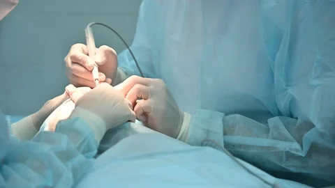Surgeon and assistant team performing facelift on unrecognizable patient Vídeo Stock 155818076