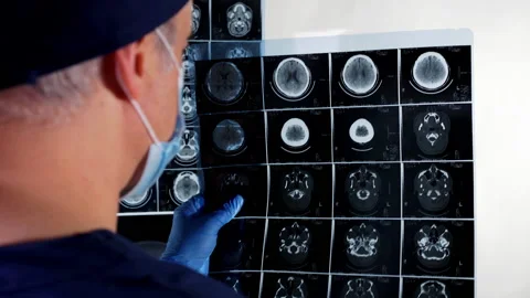 Surgeon checking MRI  Stock Footage 159421349