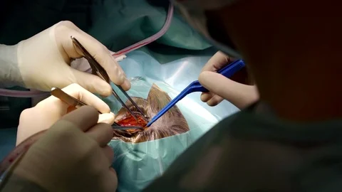 Surgeon conducting a head surgery. Stockbeeldmateriaal 100788229