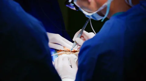 The Surgeon Conducting the Operation of Craniotomy Stock Footage 64796568