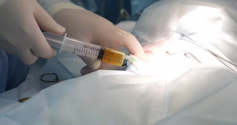 The surgeon conducts urine diversion from the bladder during the operation. The Stock Footage 220857652