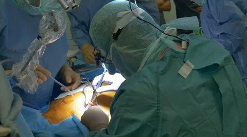 Surgeon Cutting Tissues Stock Footage 65256437
