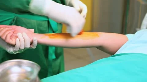 Surgeon disinfecting the forearm of a patient with a compress Stock Footage