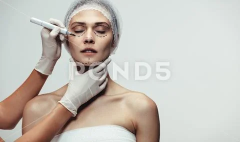 Surgeon drawing dotted lines on patient face before surgery Stock Photos