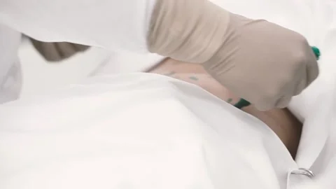 Surgeon drawing marks on abdomen, preparing woman for liposuction surgery Stock Footage 132096669