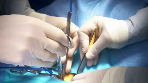 Surgeon Hands Close Up Operating Stock Footage 171141244