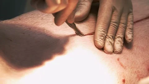 Surgeon Hands Close Up Operating with scalpel. close up of mock surgery with Stock Footage 199522949