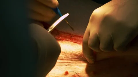 Surgeon Hands Close Up Operating with scalpel. close up of mock surgery with Stock Footage 199523206