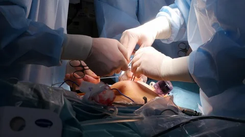 Surgeon hands during cavity surgery Stock Footage 127761018