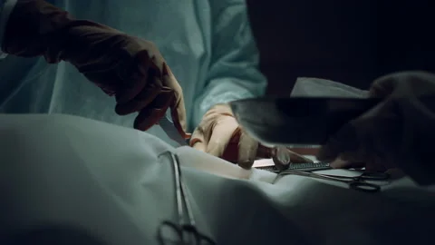 Surgeon hands making incision using scalpel in dark hospital ward close up. Vidéo 179422031