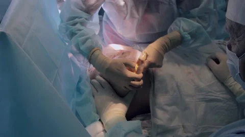 Surgeon hands performing implants explantation 스톡 동영상 68930495