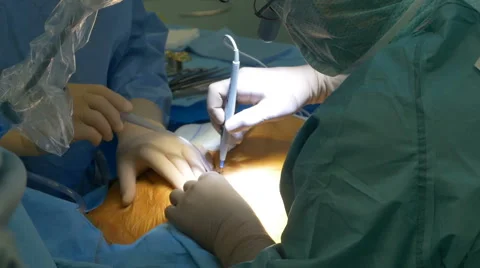 Surgeon Heart Operation Stock Footage 65256406